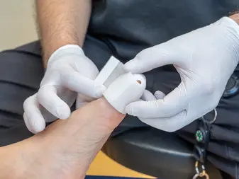 Toe wounds need covering