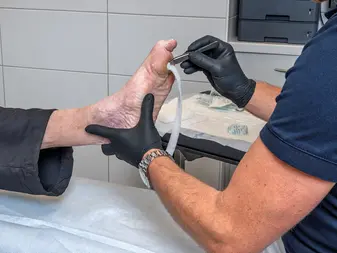Deeper wound configurations require filling
